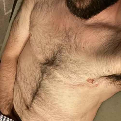 Thick & furry—any takers?