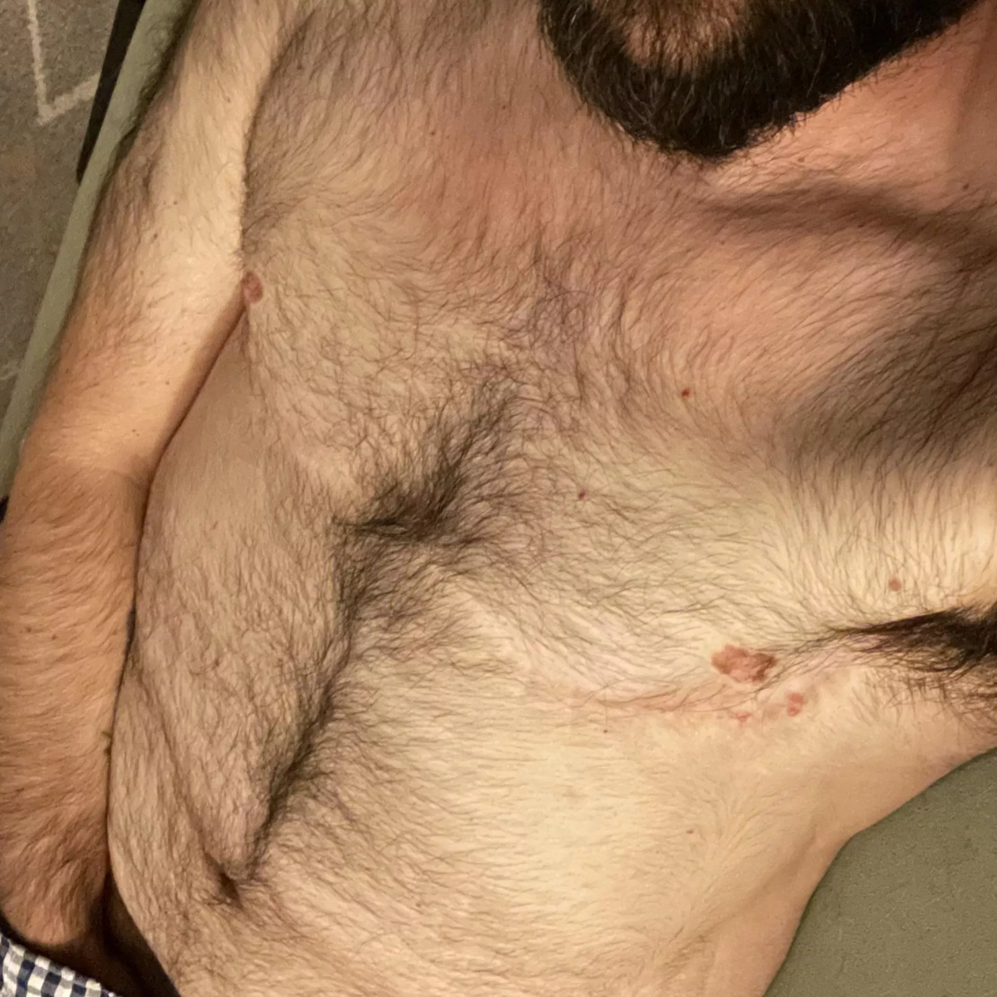 Thick & furry—any takers?