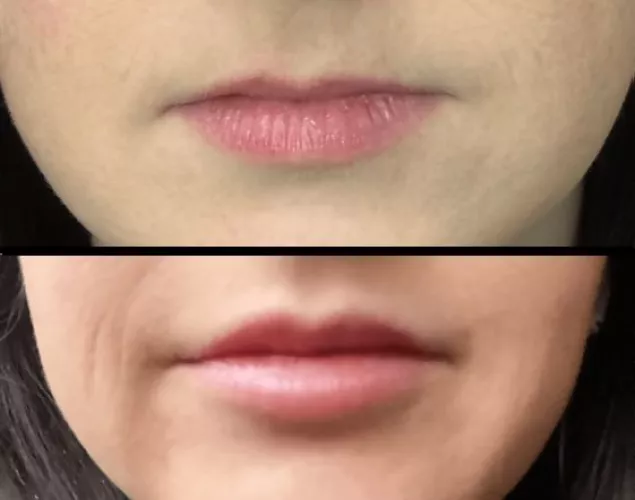 Wife got her first lip upgrades. How do they look?