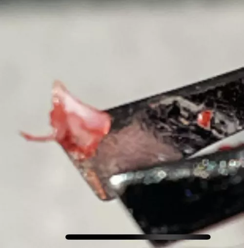 Haven’t been able to get into a podiatrist. There’s a huge wait list. Although not advised, I dug out a shard of my nail on my own. I got extremely hot, sweaty, and nauseous, but I got it out. At least some of it. And I feel so much relief. Sorry, no