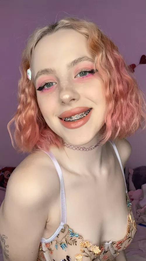 i have a thing for braces… you too?