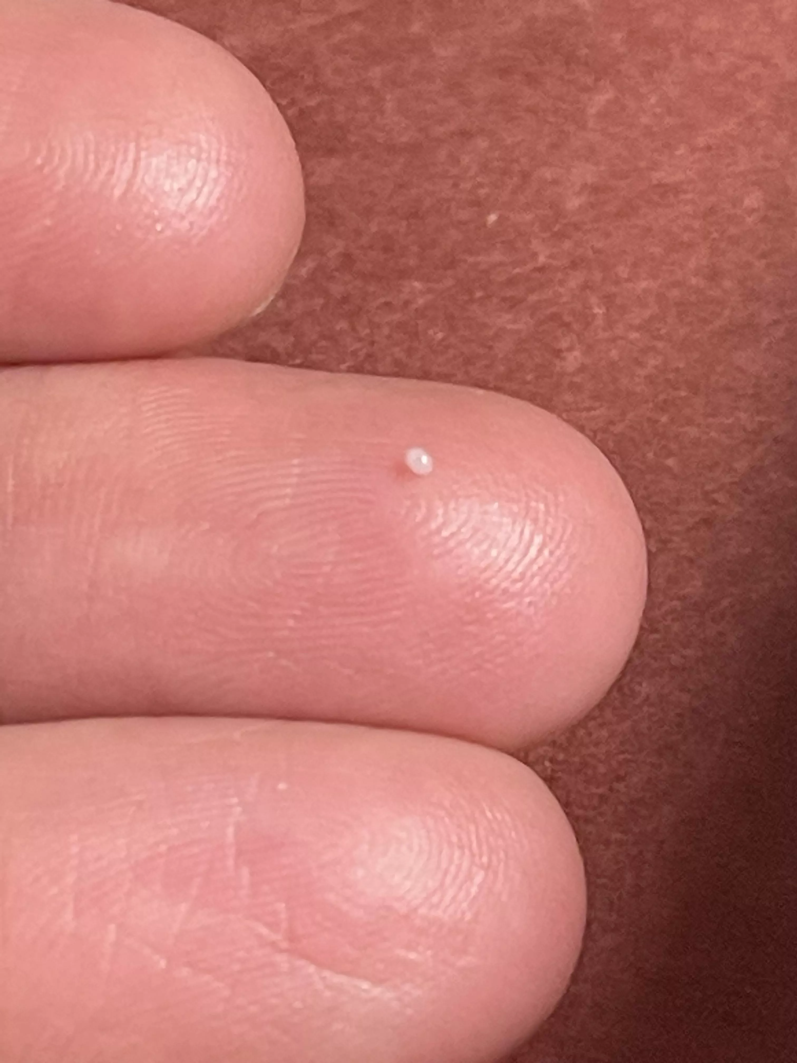 A shiny little skin pearl