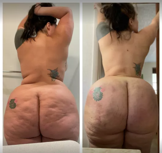 Thank god for plastic surgeons