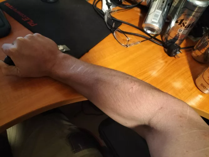 A bit odd, but I've been told it does it for some