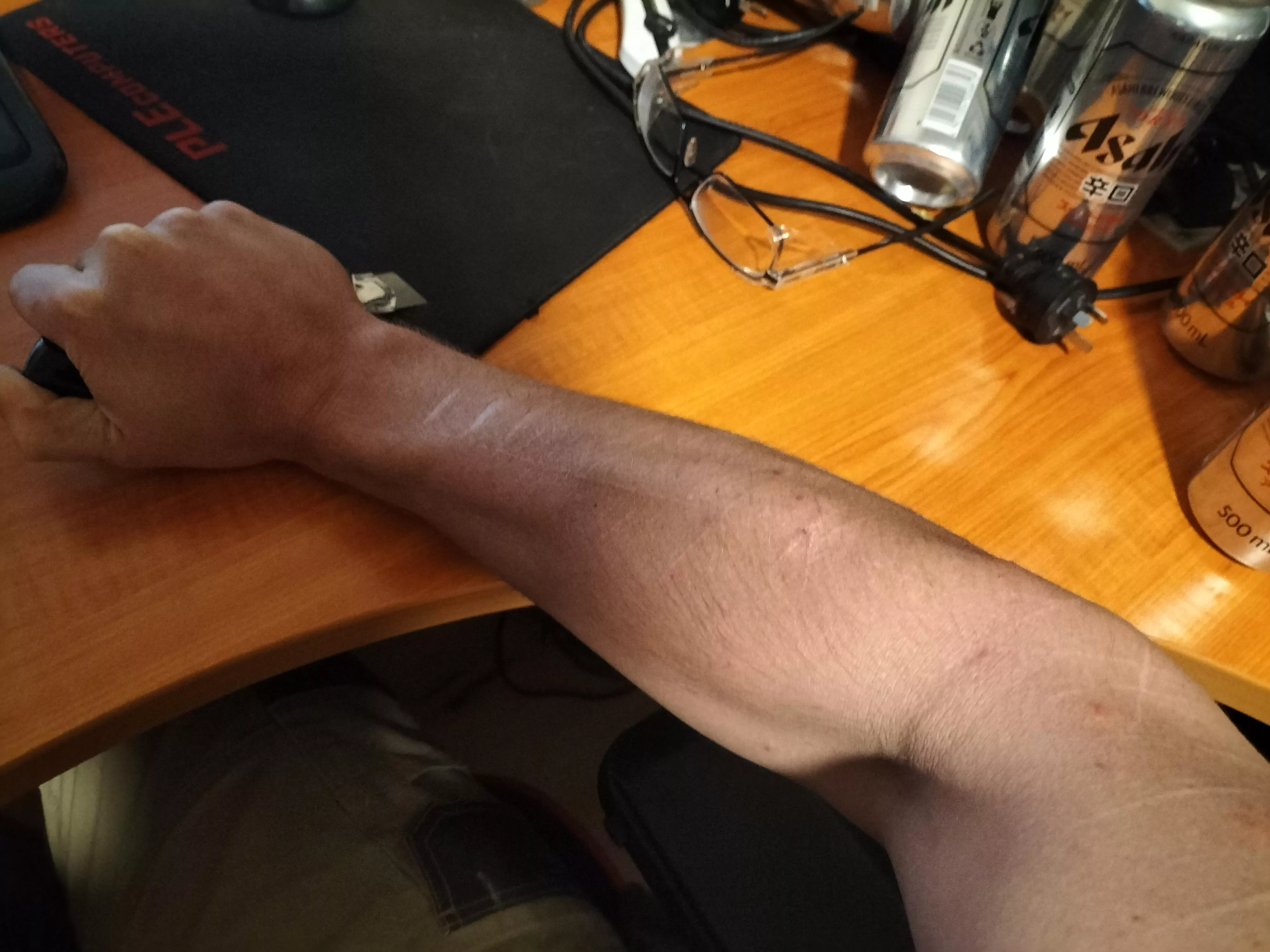 A bit odd, but I've been told it does it for some