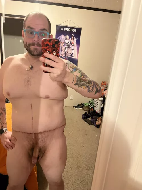 First nude since skin removal