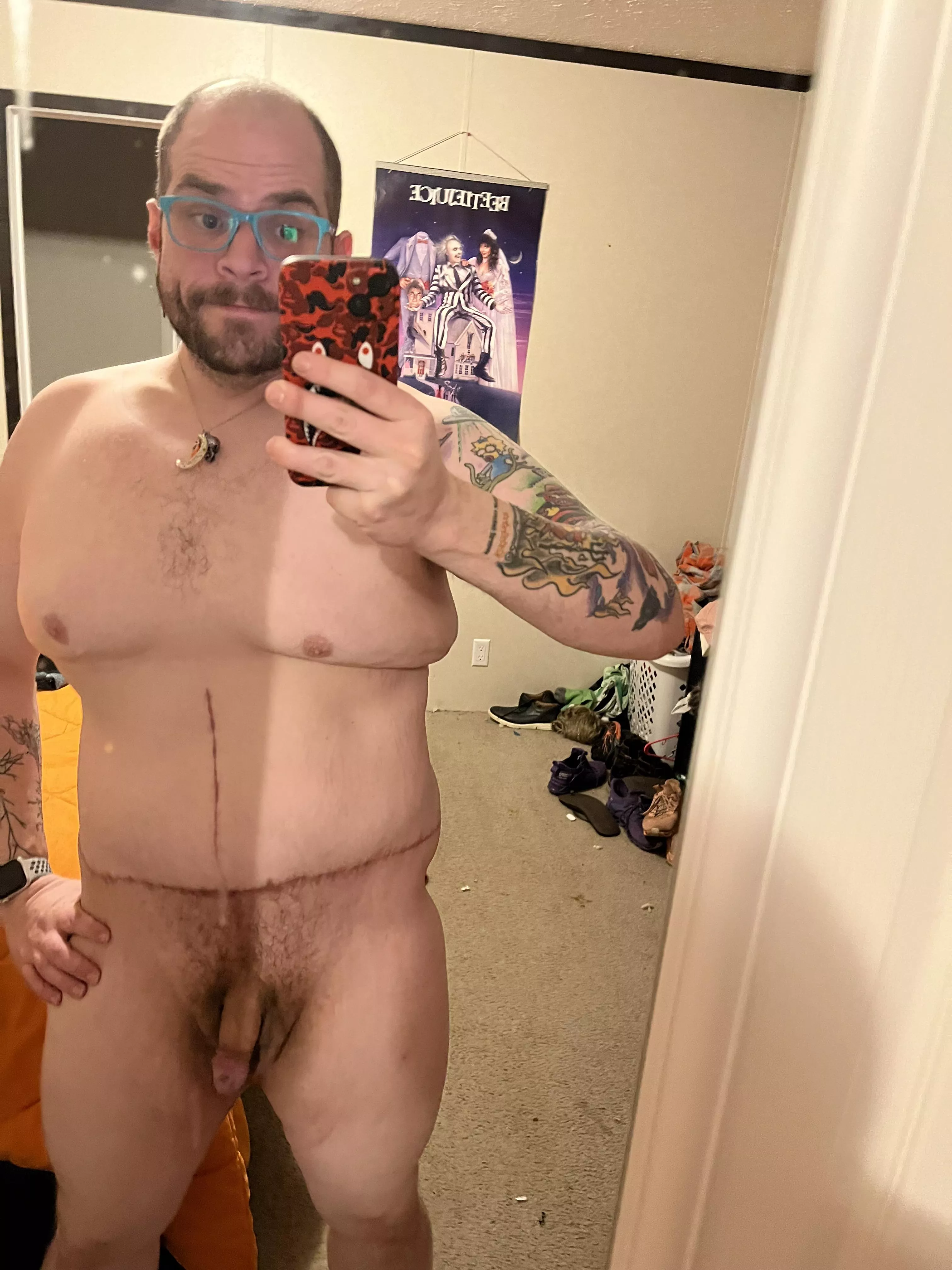 First nude since skin removal