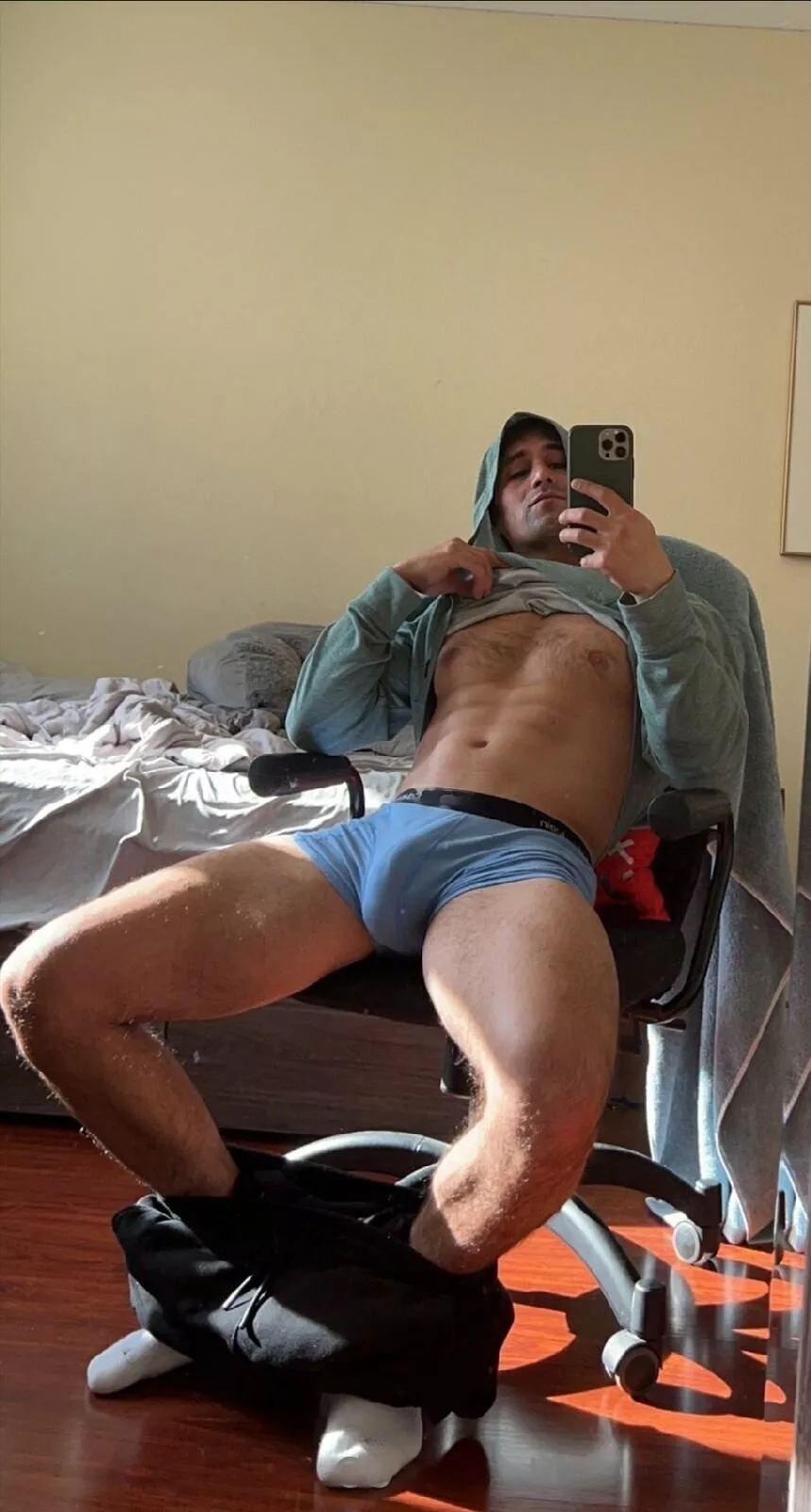 Soft bulge