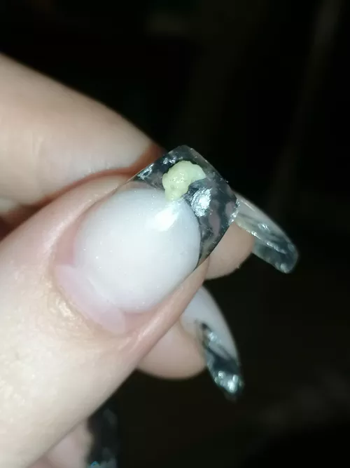 Tonsil stone that came out with a light cough. OC