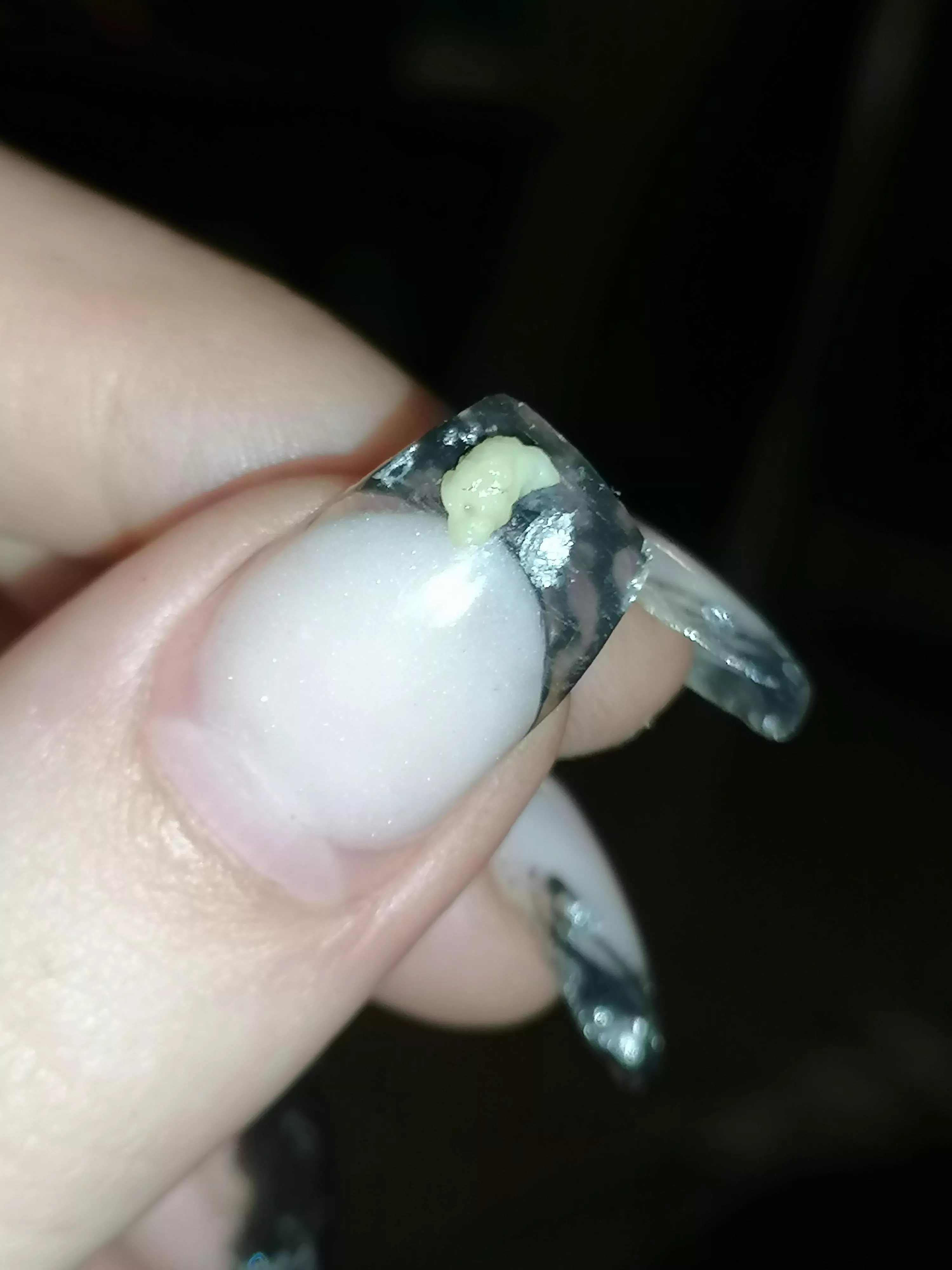 Tonsil stone that came out with a light cough. OC