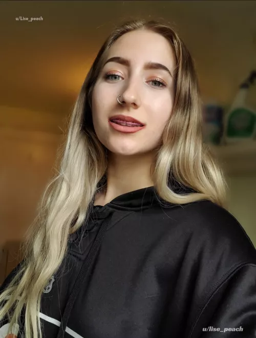 what's your preferred braces color