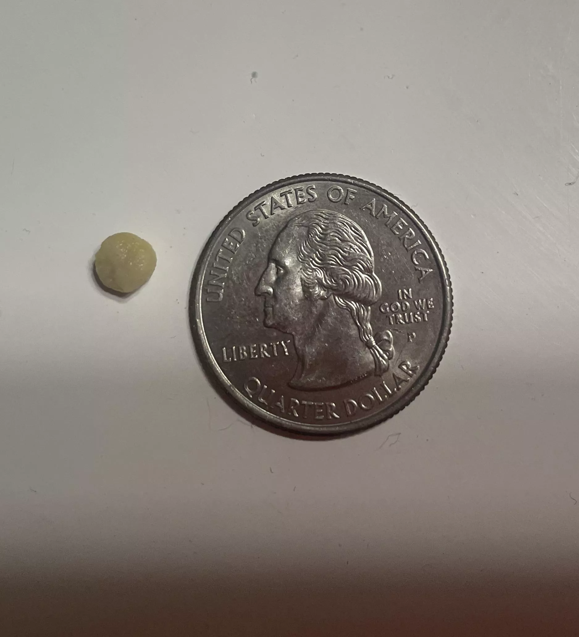 GIANT tonsil stone I found tonight wasn’t expecting it or I would have filmed