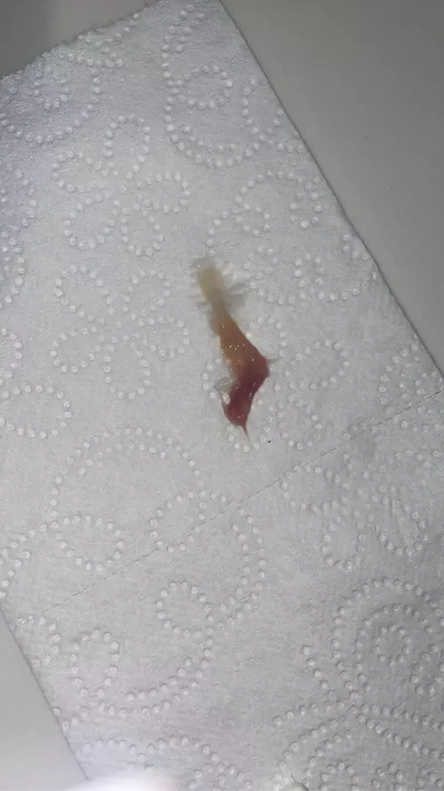 I'm sick, and felt something in my throat, so I pulled this thing out! I felt so much better afterwards. It's the size of a large paper clip irl. ***it's a clump of mucous from my sinuses that drained into my throat! NSFW because i think there is bloo