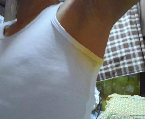 My Armpits with Yellow Sweat Stains😓