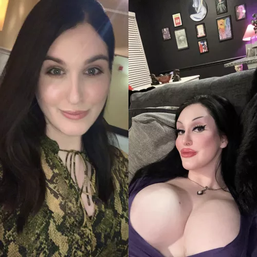 Thought I’d give you all a little update on my bimbo journey! 😘 (Full FFS, 850cc, Lip Fillers, 6 years HRT) Still wanting breast expanders at minimum of 3,500cc and a 360° BBL for next steps! I’ve had my consults already for both!