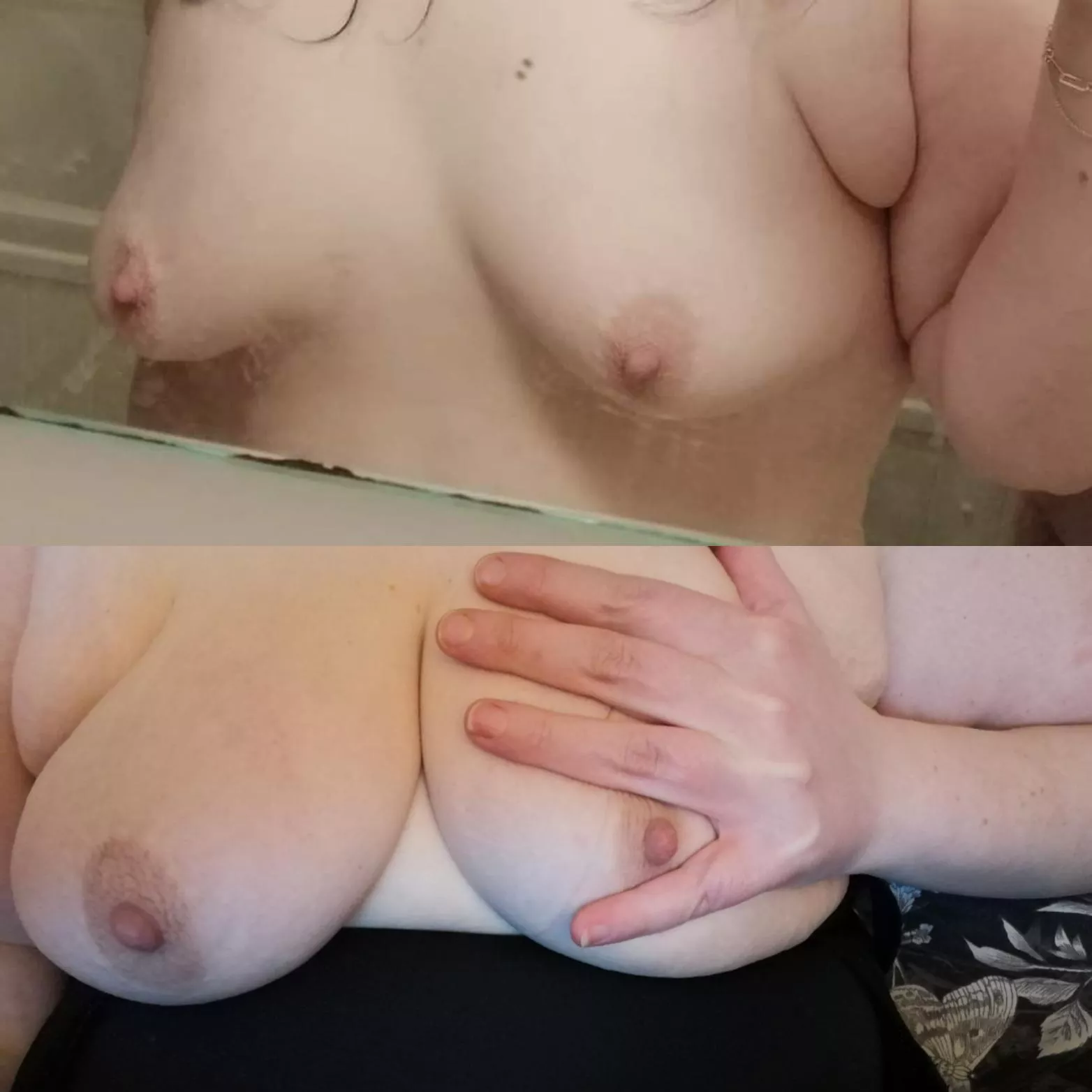 1st round of injections to grow them bigger, I'm not even close to my end goal but what a big difference 😍 1st round of injections to grow them bigger, I'm not even close to my end goal but what a big difference 😍