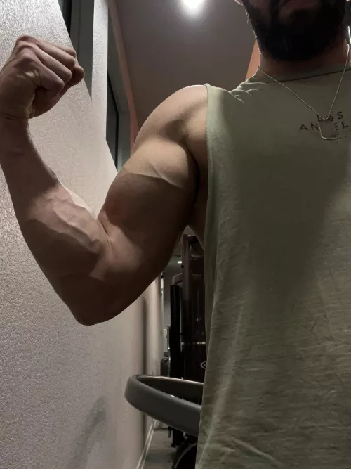 Does this community like veins?