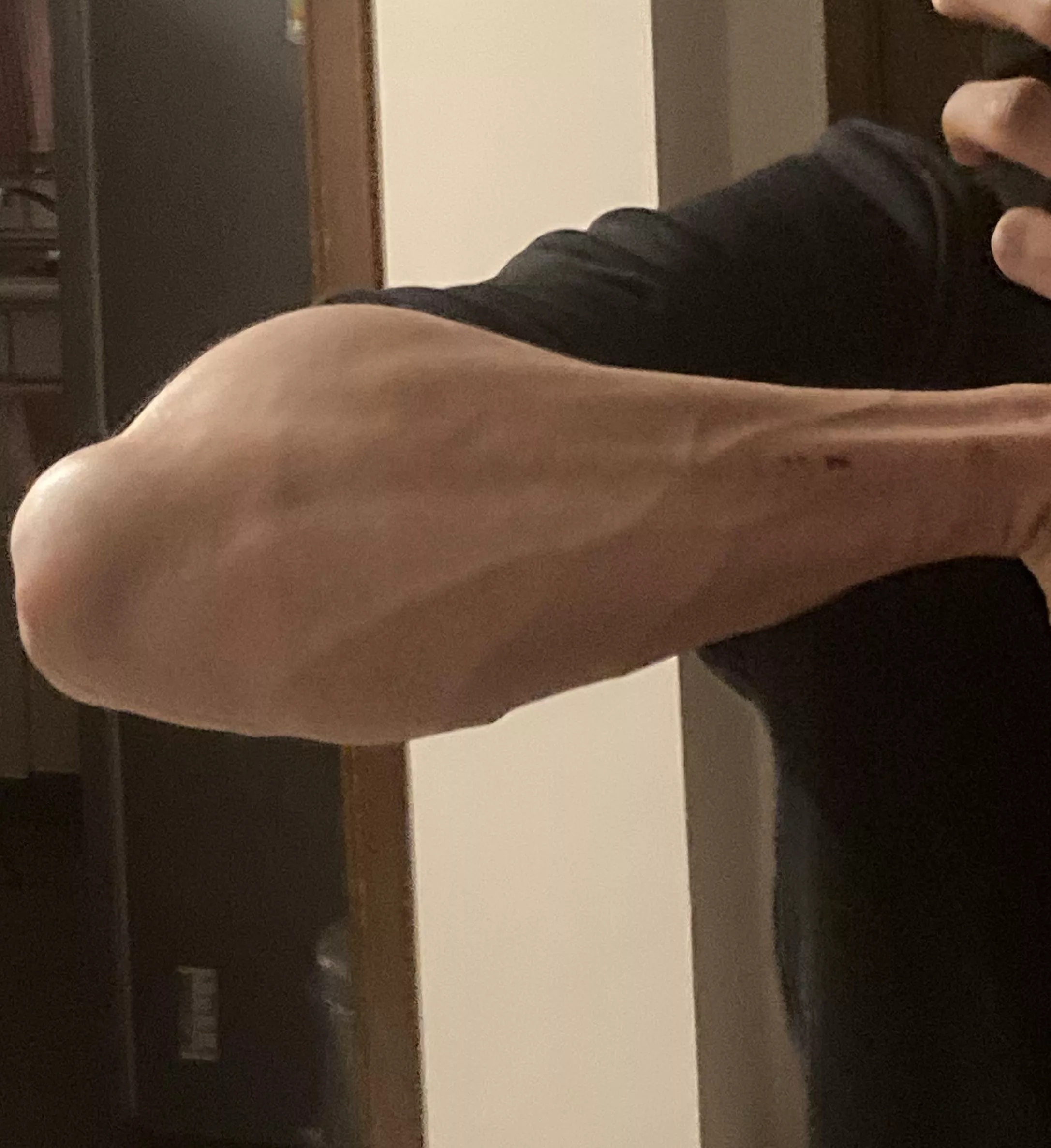 Forearm pump after a climbing session