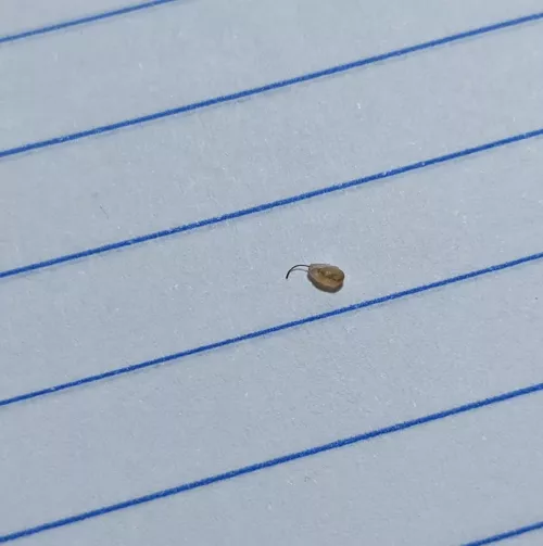 popped this out of my leg, no idea what they are but happens every few weeks.