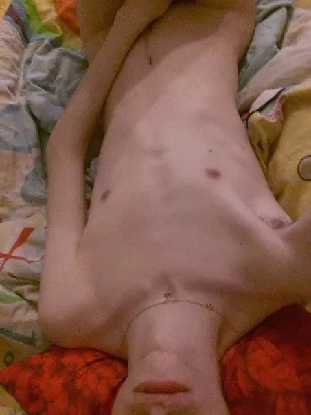 19 I have such thin arms in this photo🥺