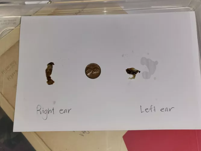 Bought gramma new hearing aids. might not have needed to after inspecting today. hearing doctor recommended upgrades. her entire ear canal was impacted on both sides. we did this at home...