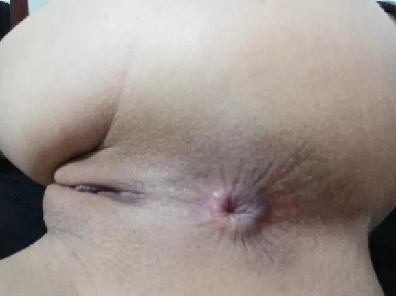 dare you come closer?