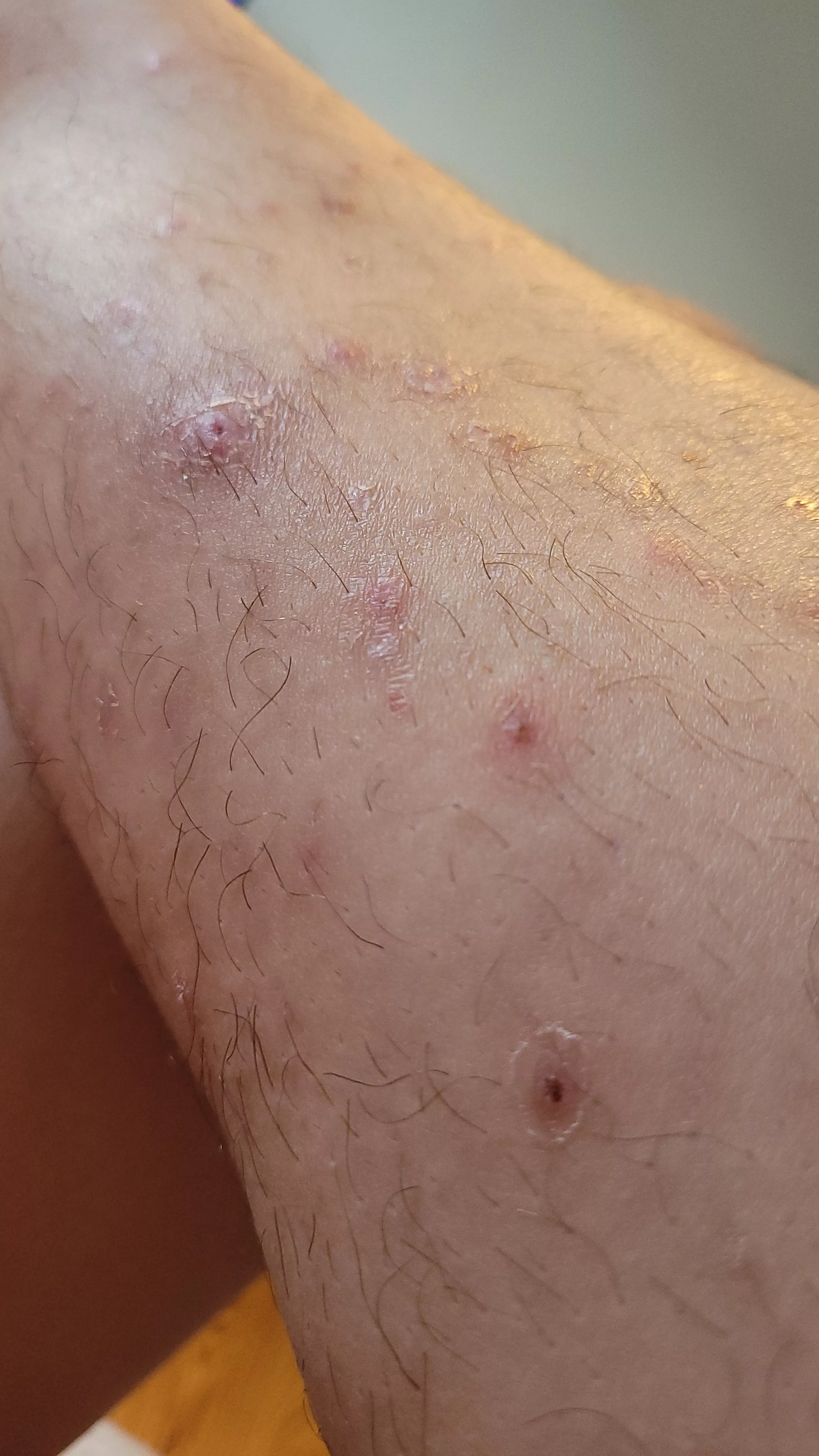 Why am I addicted to popping ?