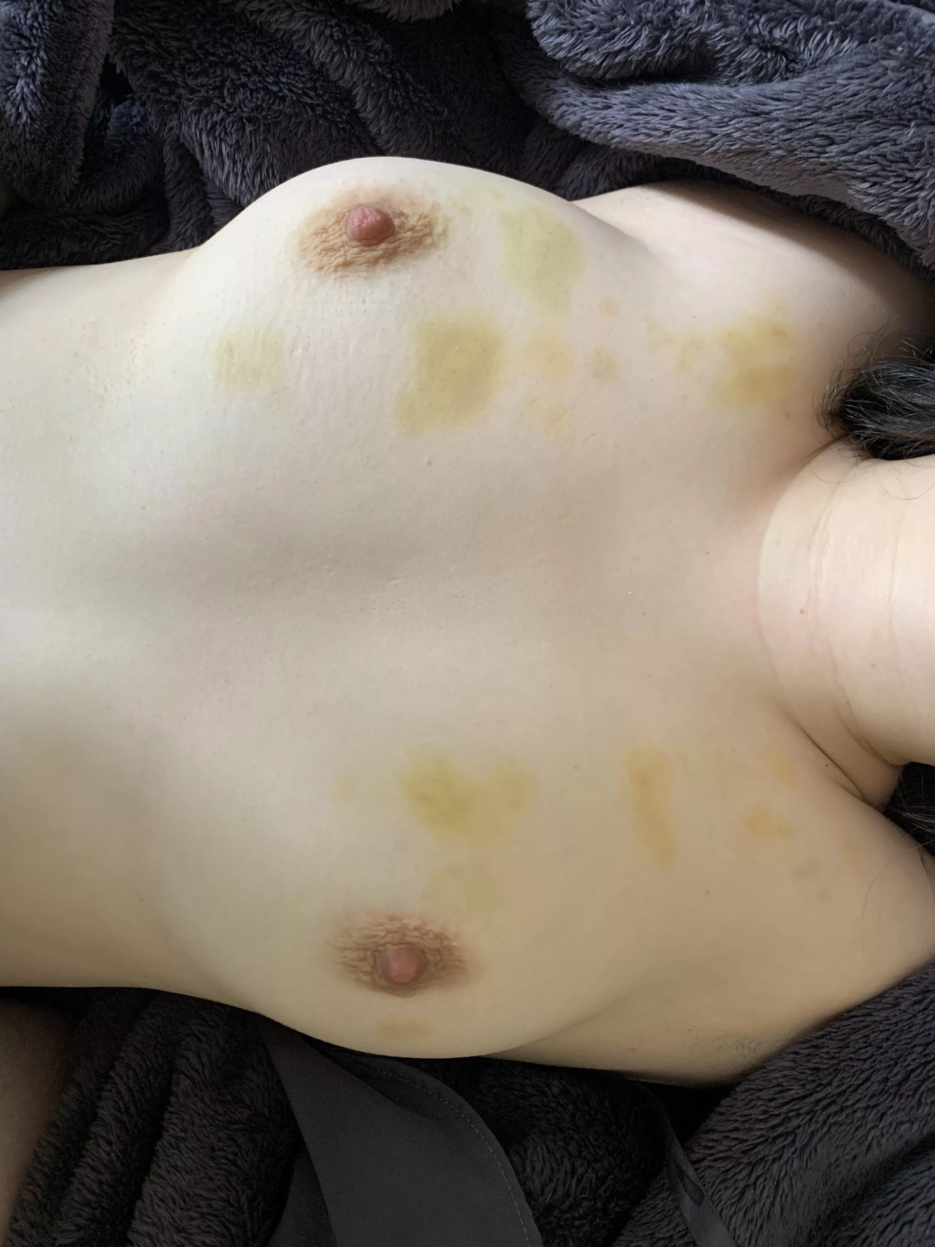 Hmmm love the feeling after a biting session [F24] OC