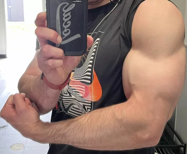 What about my hairy forearm?