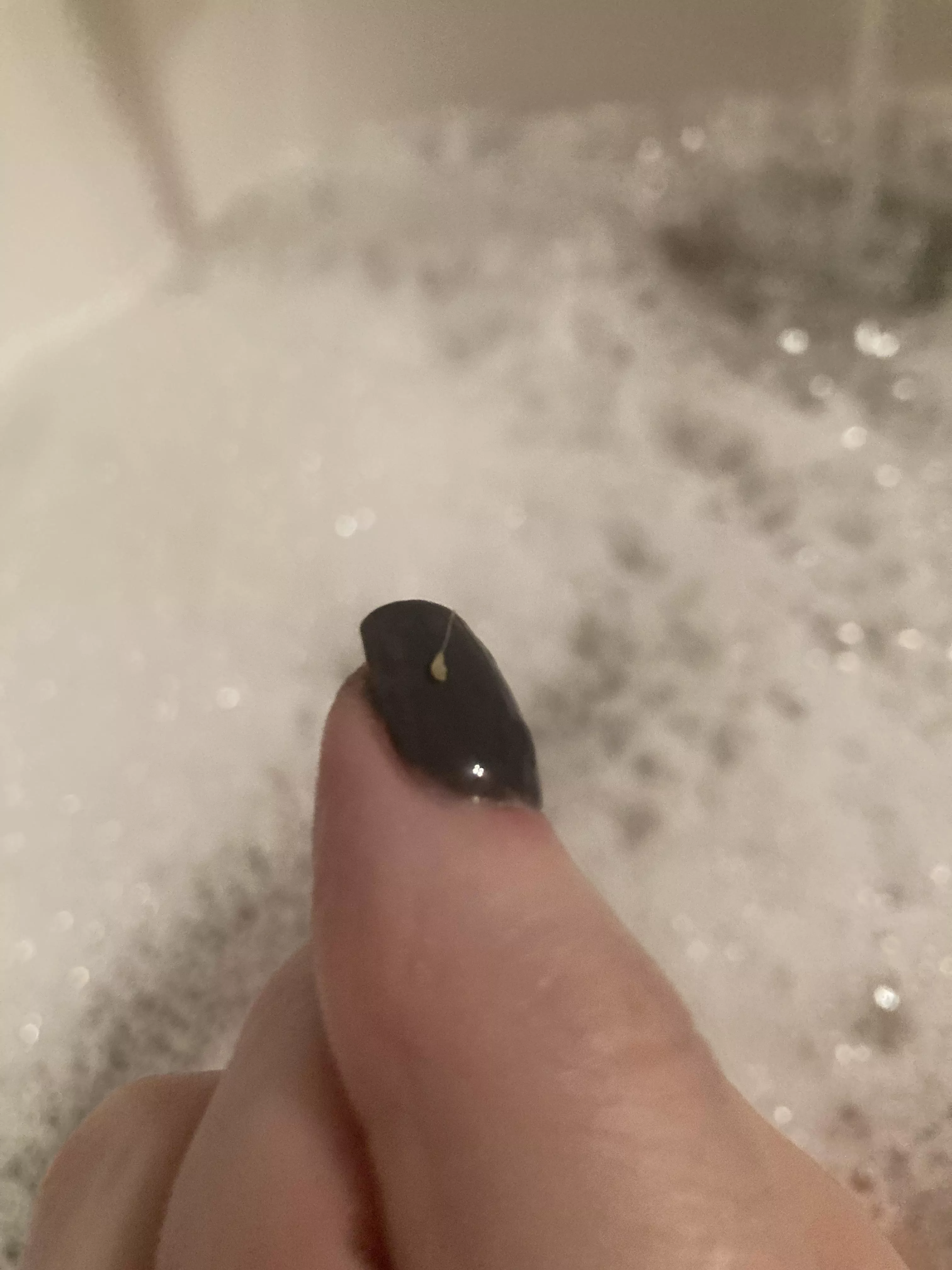 Pulled this bad boy from the back of my leg