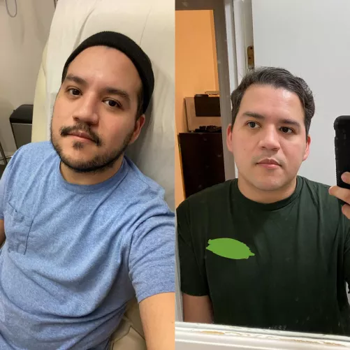 Been dealing with health issues and decided to shave. Needed a pick-me-up. Whatβs better: unshaven or shaved?