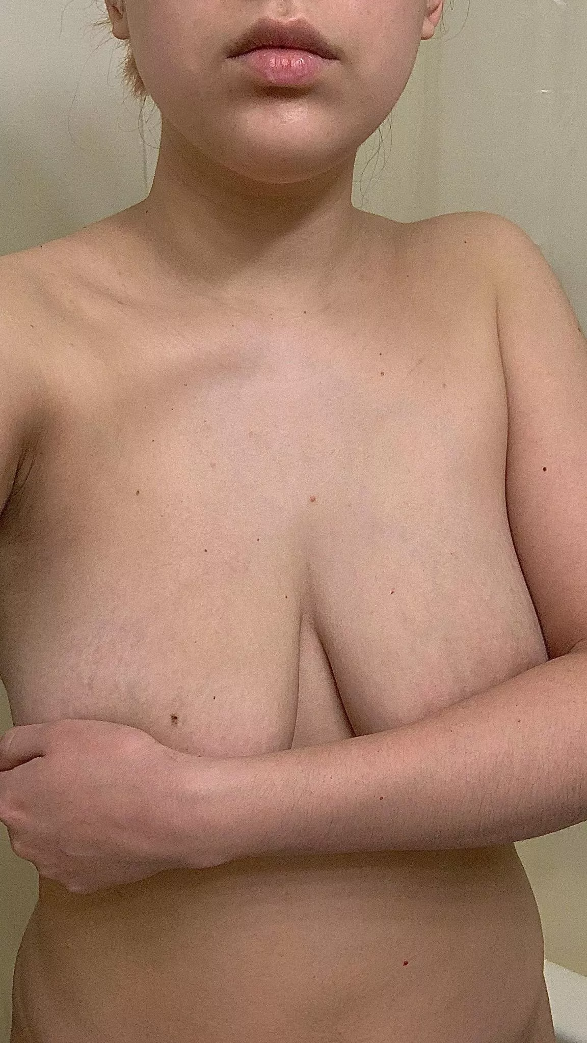 I can't bring myself to like the freckles and moles on my chest. F 25, 150lb, 5'7