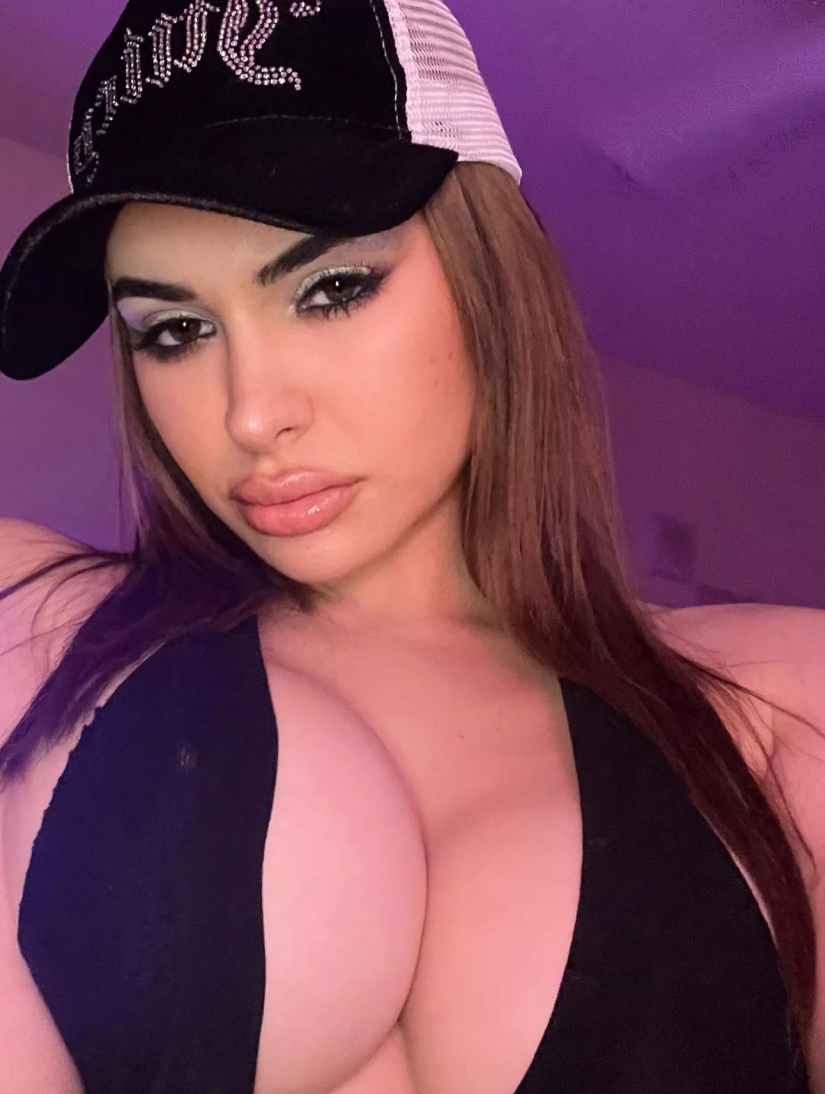 I got my lips done! And i’m already wanting another syringe!!!!