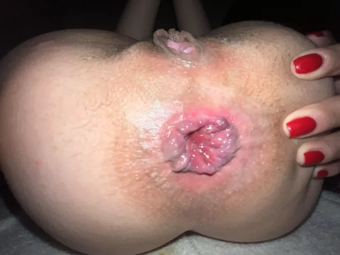 do you think you could give me a full rosebud ??