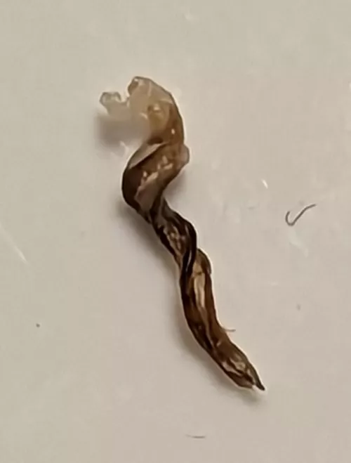 My wife pulled this little bugger out from my beard. Seems to be two ingrown hairs intertwined with each other
