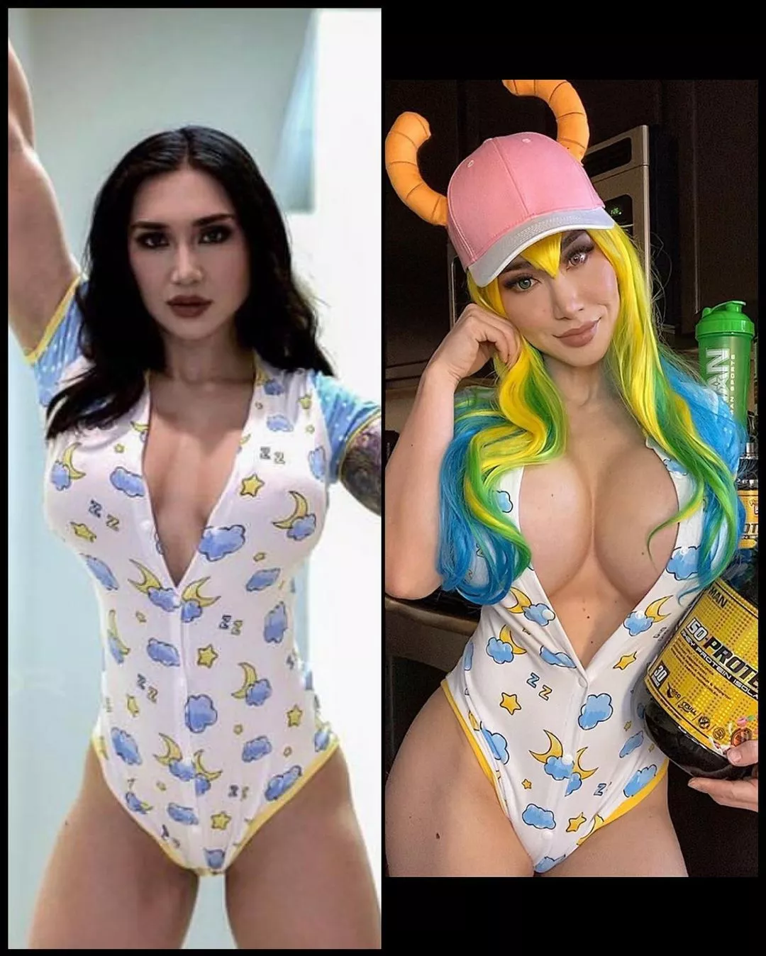 Old implants vs new implants in the onesie