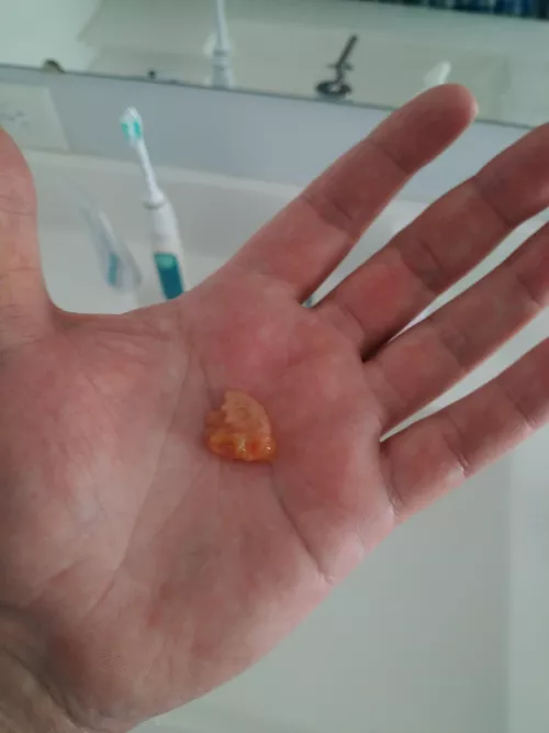 Sinus infection for 2 weeks. Instant relief!