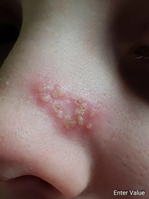 Forbidden pops probably, dunno what this is