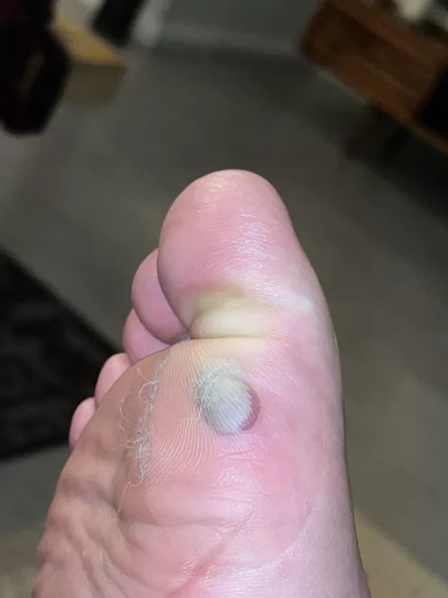 The urge to pop it is overwhelming