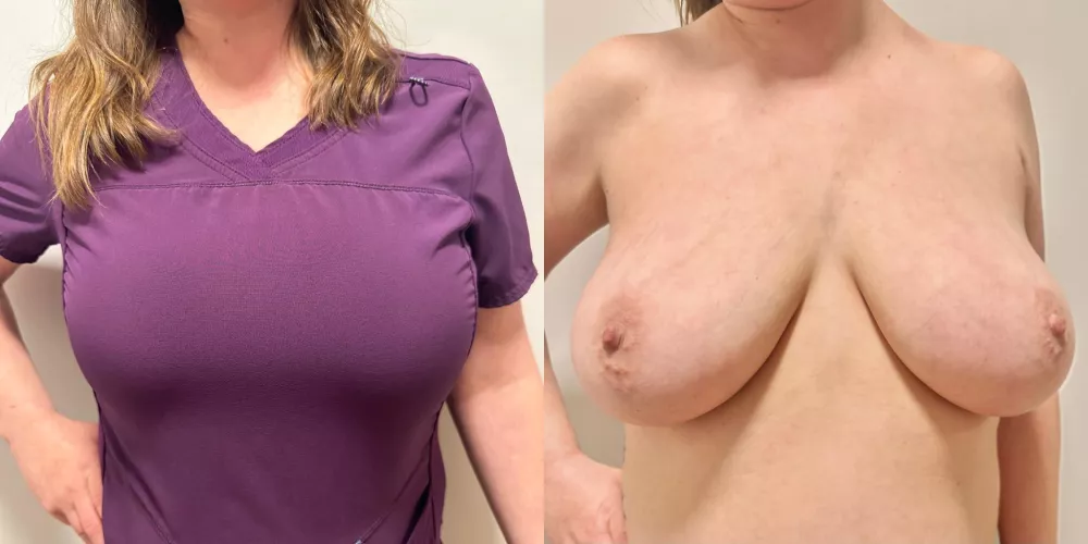 Can I titty fuck you during an exam?😊