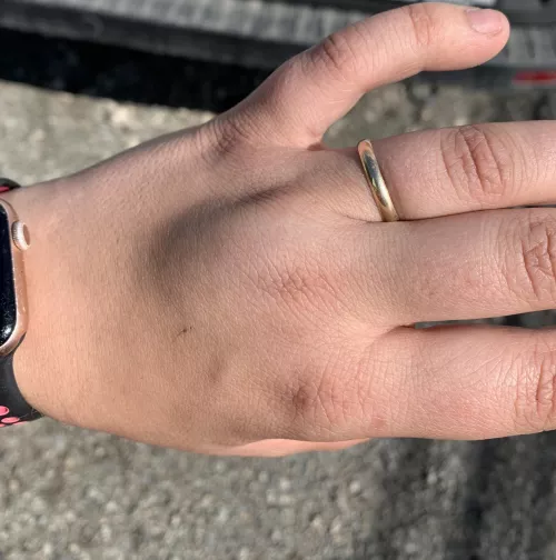 Forbidden pop, hand got caught between a drill and a pole then this suddenly appeared