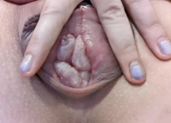 I pumped only the inner this time, I'm in love about how it [f]eels and the prolapsed like look😍🤤