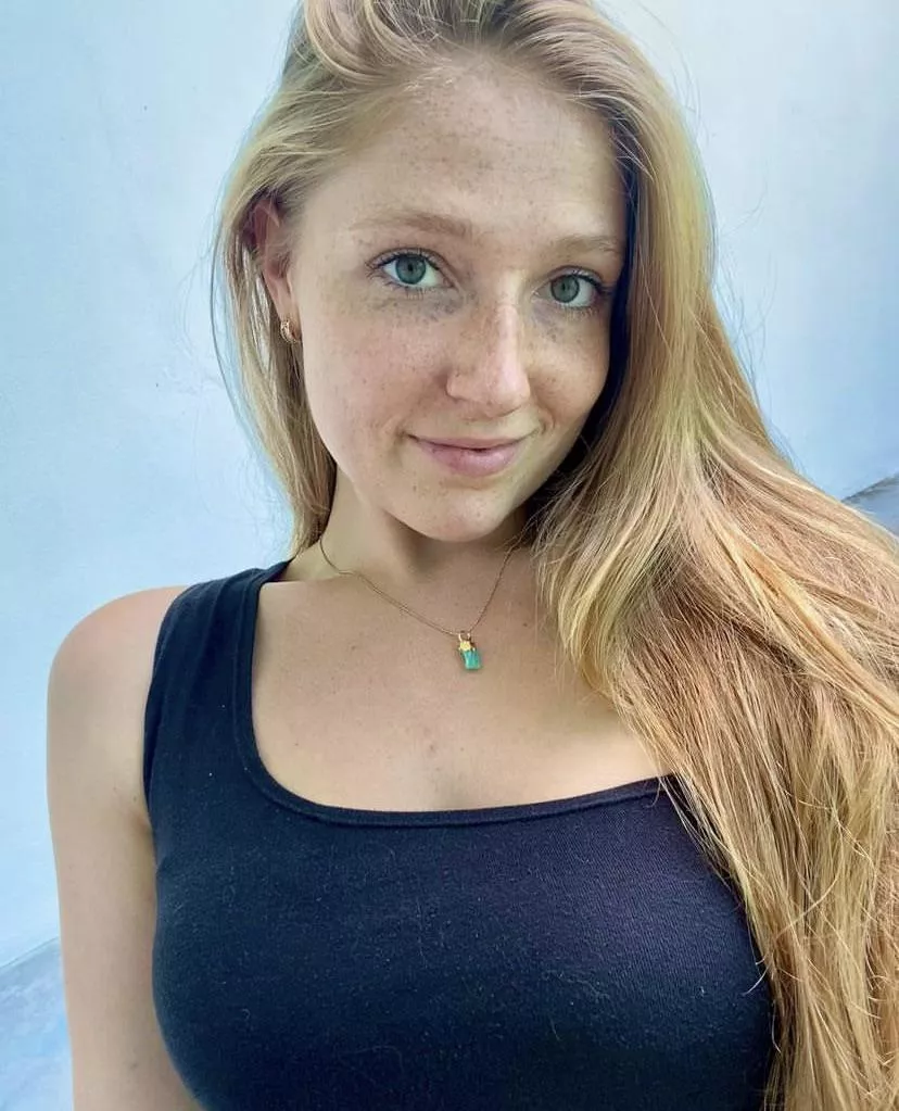 Calling all freckle lovers 📣