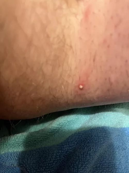 I simply can’t believe it hadn’t already popped!