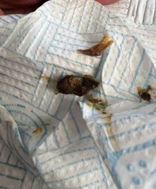 My husbands ears are disgusting lmao he almost threw up at this