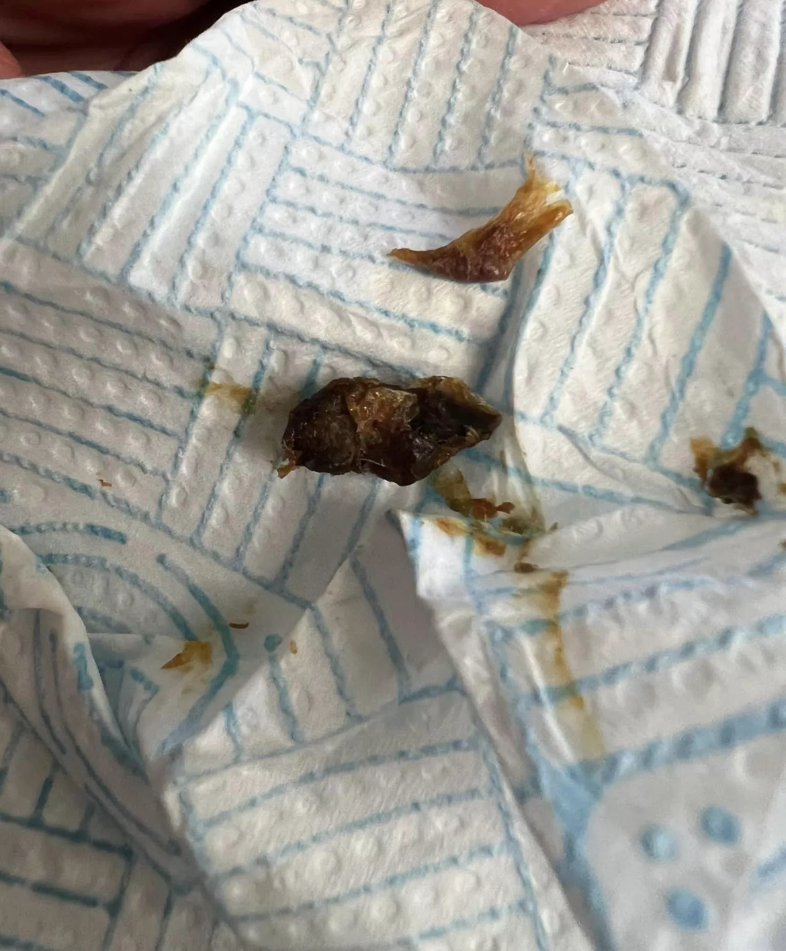 My husbands ears are disgusting lmao he almost threw up at this