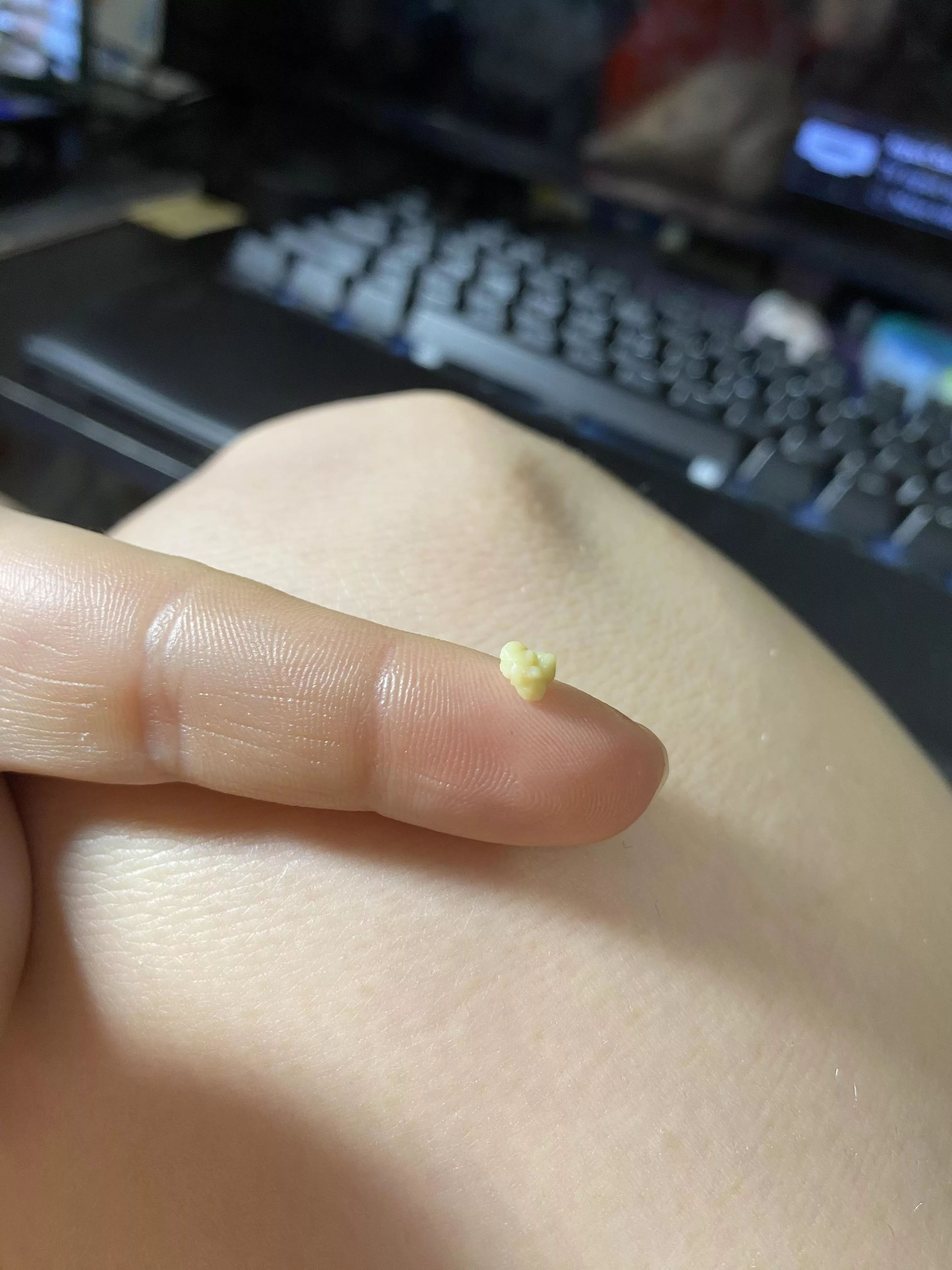 No wonder my throat hurt… I can feel more back there.