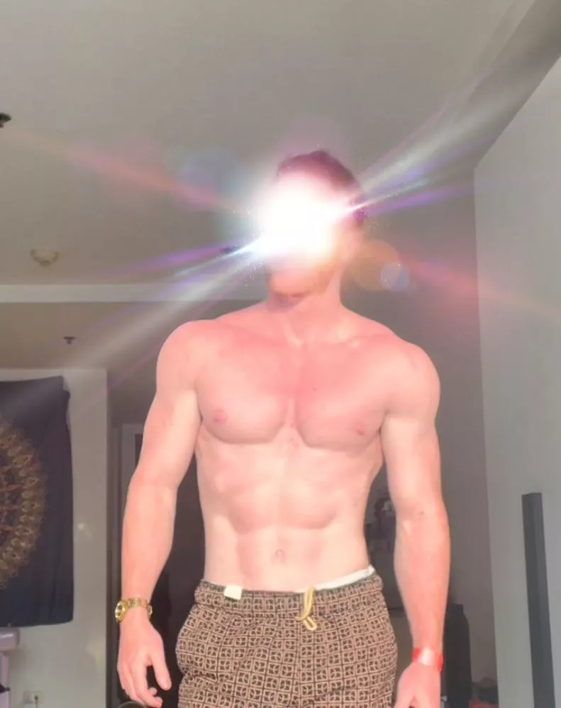 Rub some cream on my burn?