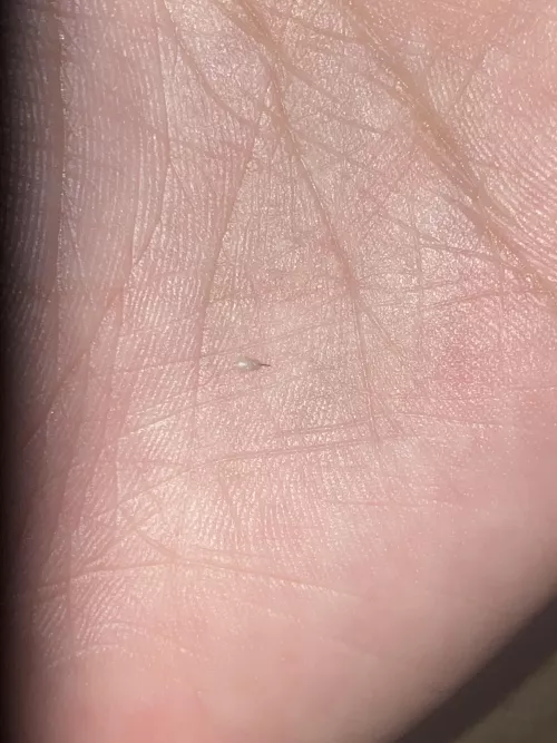 Popped this out of my ass and it’s recurring what exactly is it? There’s always hair in this bead?
