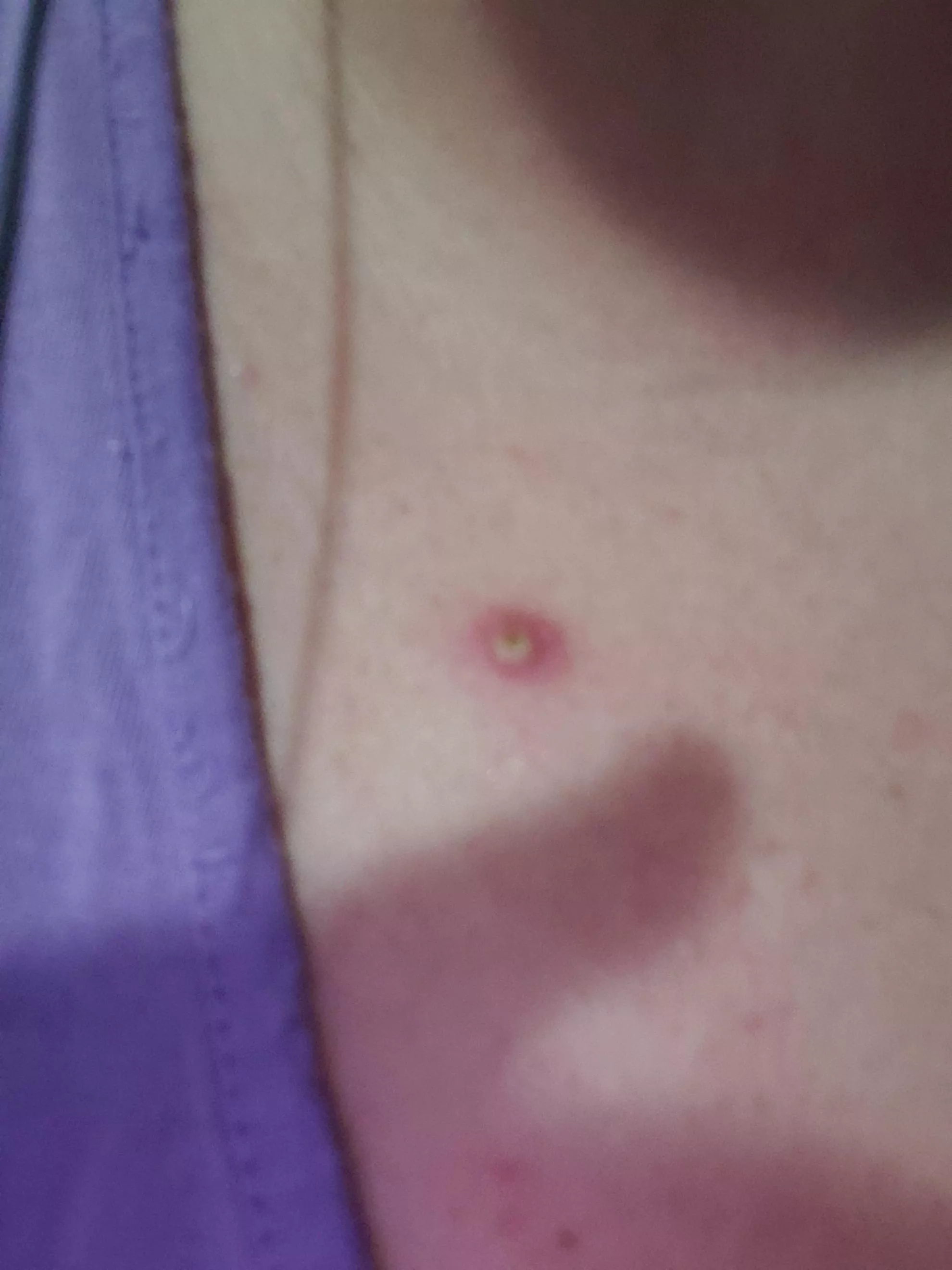 I may have to break up with my fiance She won't let me pop this monster!